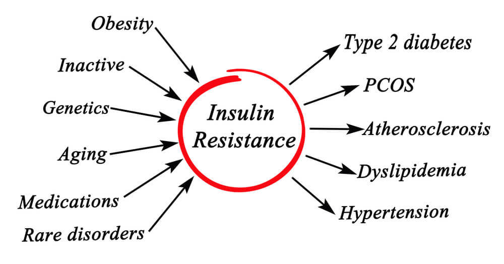 infographic insulin resistance